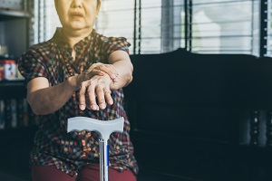 This is a picture of a patient holding her arm out in front of her.